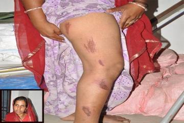 Husband Beats Wife After Second Marriage ??? ?? ?? ????? ????, ???? ????? ?? ?????? ?? ??????? ? ???-?????? ?? ????