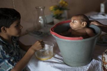 AP photographer reflects on 'bucket baby' in Brazil